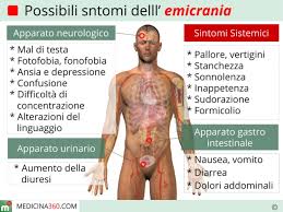 Sintomi Dell Emicrania