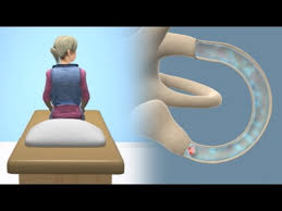 If you have any of these problems, please. Epley Maneuver To Treat Bppv Vertigo Youtube