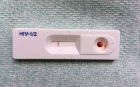 Lab tests are important tools. Hivindv Types Of Hiv Test
