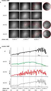 Real dads immediately reassure the child they did nothing wrong and tell them they did the right thing by. Platelet Adhesion And Aggregate Formation Controlled By Immobilised And Soluble Vwf Bmc Molecular And Cell Biology Full Text