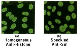Image result for ANA Staining Pattern