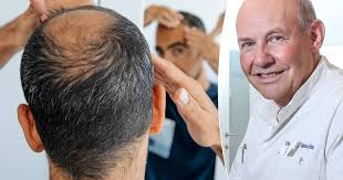 “Sneetjes in je hoofdhuid zouden haaruitval meteen doen stoppen.” Helpt een  'galeatomie' echt tegen uitdunnend haar?