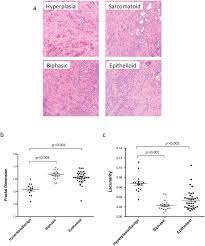 In fact, most people don't even know what it does. Unique Fractal Evaluation And Therapeutic Implications Of Mitochondrial Morphology In Malignant Mesothelioma Scientific Reports