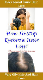 Pin By Hair Loss Never On Thinning Hair No More Help Hair Loss Scalp Hair Loss Hair Loss Men