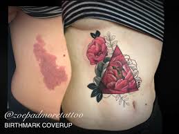 Arm Birthmark Cover Up Tattoo Pin On Tattoo Envy
