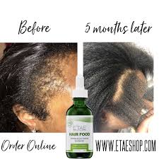Foods with iron are essential for supporting healthy hair growth. E Tae Natural Products Retail Salon Beauty Product Supplier In Wyncote