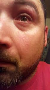 Affordable and search from millions of royalty free images, photos and vectors. Tifu By Rubbing My Eye After I Killed A Spider Again Tifu
