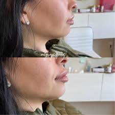 Modern Luxe Aesthetics LLC