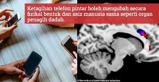 Kebaikan dan keburukan menggunakan telefon pintar pada masa kini, telefon pintar telah dianggap sebagai satu gaya hidup semua golongan masyarakat tidak kira samada dari golongan atasan atau kelas pertengahan. Ketagihan Telefon Bimbit Sebabkan Otak Seseorang Berubah Secara Fizikal