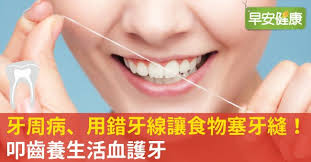 牙周病 用錯牙線讓食物塞牙縫 叩齒養生活血護牙 oral dental oral care