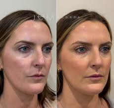 Anna Cios's Instagram, Twitter & Facebook