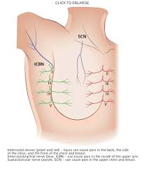 Image result for Mastectomy