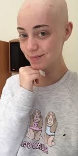 Model shares harrowing photo of 15th suicide attempt after losing her hair  triggered depression