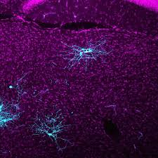 Improved Brain Mapping Tool 20 Times More Powerful Than Previous Version Neuroscience News Brain Mapping Neural Connections Neuroscience