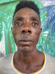 Blondedy Ferdinand✓