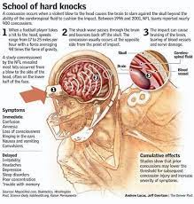 Sleeping With A Concussion Brain Injury Traumatic Brain Injury Brain Diseases