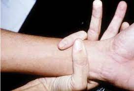 Automated Marfan Syndrome Diagnostic Checklist