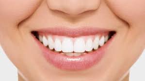 The cost of fixing a chipped tooth varies widely, typically ranging from as little as $100 to as much as $3,000. Dental Bonding Markham Markham Dentists Forestbrook Dental Clinic