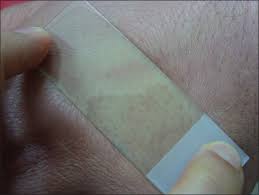 Image result for Diascopy