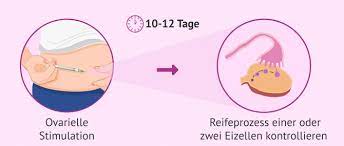Insemination Ablauf Methoden Und Kosten