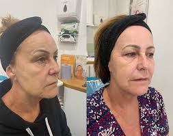 Doctor Led Aesthetics Clinic and Skin Treatments in Surrey