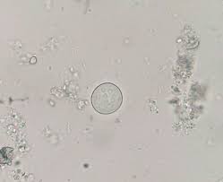 Quiste De Entamoeba Coli Al Fresco Parasitologia