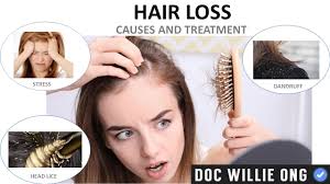 Hair loss during the menopausal transition can be just as dramatic as menopausal hair loss. Health Guide By Dr Willie Ong Hair Loss Causes And Treatment By Doc Willie Ong Reader S Question I Am 31 Years Old And My Hair Has Become Thinner Every Time I