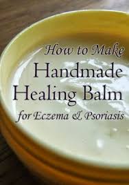 Handmade Neem Balm For Eczema And Psoriasis Soins De La Peau Naturels Peau Naturelle Regime Psoriasis