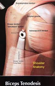 Shoulder Anatomy Is Very Complex The Shoulder Joint Is The Only Joint In The Boday That Can Do Circumdu In 2021 Shoulder Anatomy Shoulder Joint Anatomy Shoulder Joint