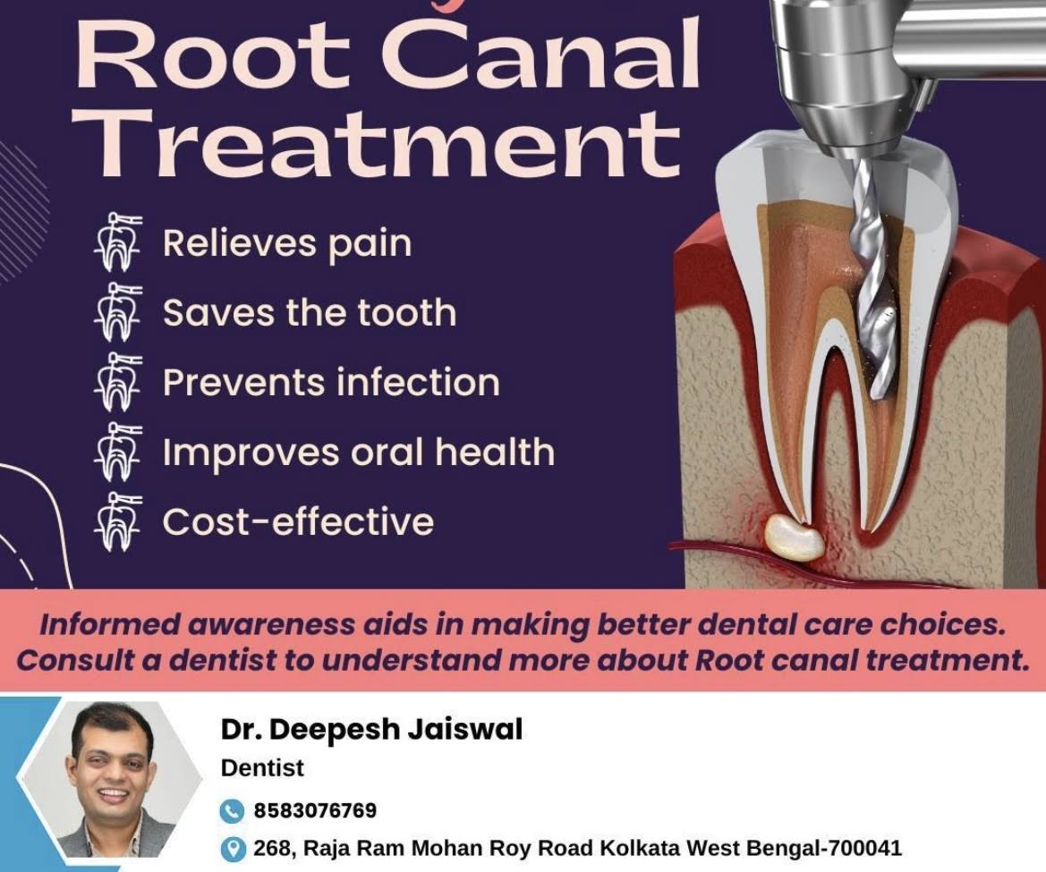Root Canal Treatment product image