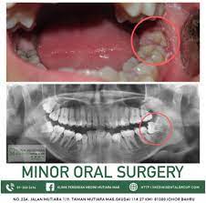 Check spelling or type a new query. Pembedahan Gigi Klinik Pergigian Medini Mutiara Mas Facebook