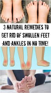 3 Natural Remedies To Get Rid Of Swollen Feet And Ankles In No Time Swollen Ankles Natural Remedies Swollen Feet Remedy