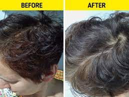 Causes Of Hair Loss, And 7 Ways To Tell If You're Losing Too Much Of