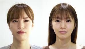 銀座の美容外科 マックスファクス銀座クリニック