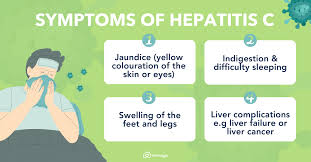 Image result for hepatitis symptoms