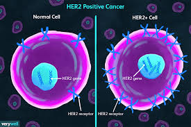 Creative, emotive, faithful, loving and charming, intuitive. Her2 Positive And Negative Breast Cancers Aggressiveness Treatment And Survival
