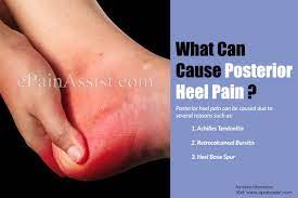 Pin On Joint Pain