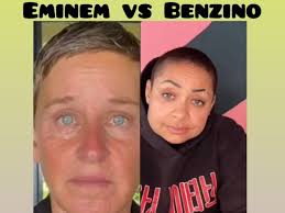 Between the ears of Jethro Bodine. ❤️ ☕️ 🐕