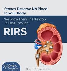 Retrograde Intrarenal Surgery Rirs Is A Safe Procedure To Treat Renalcalculi Or Kidney Stones Which Involves Quicker E In 2020 Renal Calculi Urologists Kidney Stones