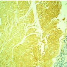 Image result for Liparis killmanniae