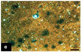 The test of the head is to find a camel,. Ijms Free Full Text Bridging The Gap Between Alzheimer S Disease And Alzheimer S Like Diseases In Animals Html
