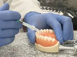 Sometimes life gets in the way, so if you do need more. How Long Does It Take To Fill A Cavity Teethwalls