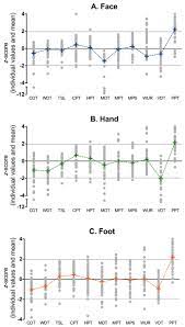 Looking for online definition of mpt or what mpt stands for? Cornea Nerve Fiber Quantification And Construction Of Phenotypes In Patients With Fibromyalgia Scientific Reports
