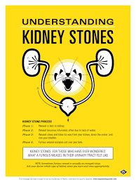I Wonder What A Weasel In Your Kidney Feels Like Kidney Stones Funny Medical Posters Kidney Stones