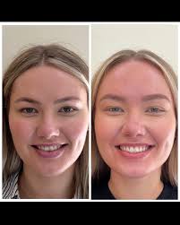 Show me a smile and I will show you...