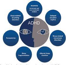 The Rhythm Of Adult Adhd On The Relationships Between Adhd Sleep And Aging Semantic Scholar