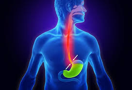 Raising your head about six inches will also allow gravity to influence the contents within your stomach. Ways To Relieve Acid Reflux Gerd Heartburn