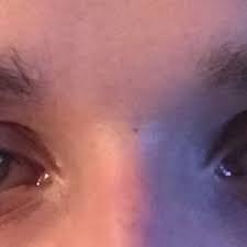 Jun 21, 2017 · as you grow older, your skin loses collagen, and your eyelid muscles grow slack. My Eyes Look Symmetrical In The Mirror But They Don T In Iphone Pictures Are My Eyes Asymmetrical And Why Photos