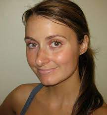 Read about sunscreen types, ingredients, how sunscreen works, and how ultraviolet (uv) rays can cause skin cancer and melanoma. Still Not Wearing Sunscreen Look At These Photos Glamour
