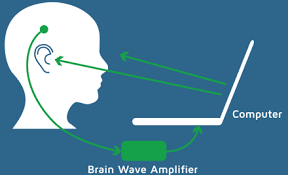 The goal of all neurofeedback is to transform an unhealthy, dysregulated brainwave pattern into a normal, healthy, organized pattern. What Is Neurofeedback Biobalance Integrated Wellness